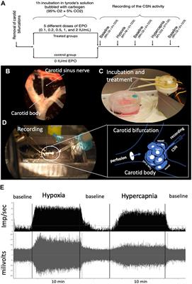 Erythropoietin Produces a Dual Effect on Carotid Body Chemoreception in Male Rats